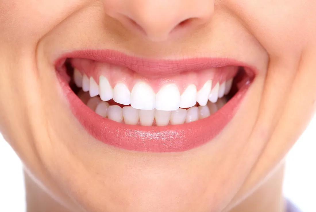 Veneers vs. Crowns: Which One Do I Need?